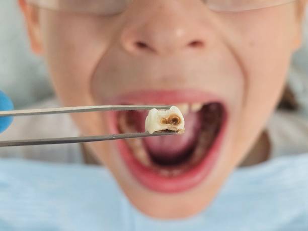 Best Pediatric Emergency Dentist in Turley, OK
